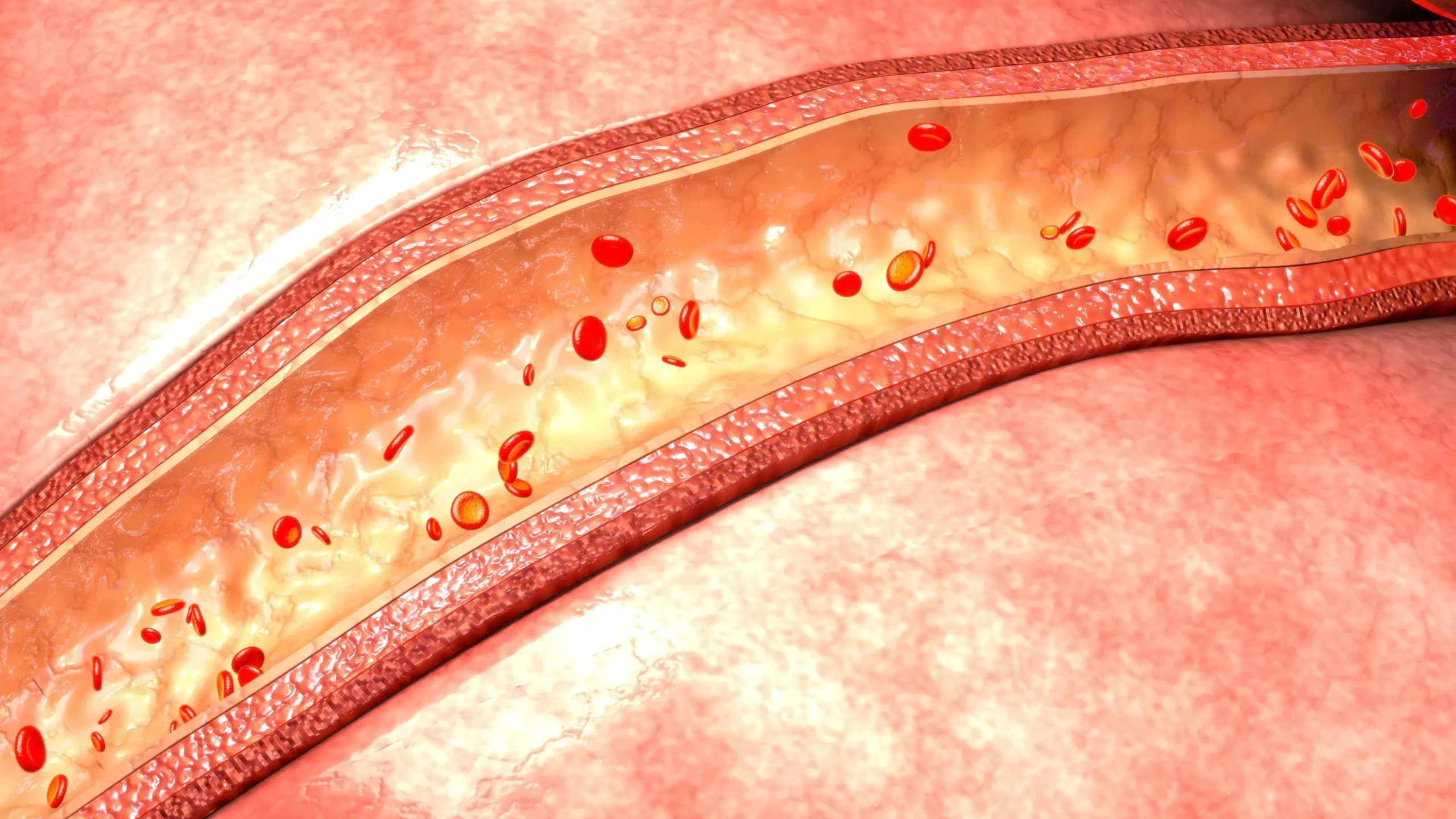 Cómo mejorar la circulación en las piernas: guía completa - Qué puede causar la mala circulación de la sangre mala circulacion en las piernas - Qué puede causar la mala circulación de la sangre