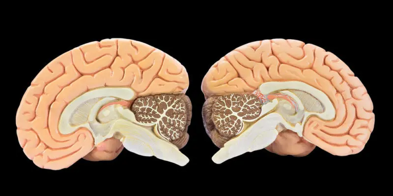 Materia Gris del Cerebro: Función, Importancia y Factores que la Afectan - Qué reduce la materia gris del cerebro materia gris del cerebro - Qué reduce la materia gris del cerebro