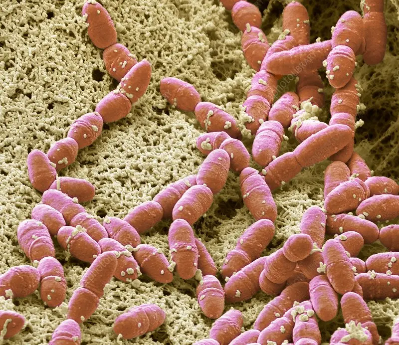 Streptococcus mutans: La Bacteria que Provoca Caries y Más - Qué región del cuerpo coloniza el Streptococcus mutans streptococcus mutans - Qué región del cuerpo coloniza el Streptococcus mutans