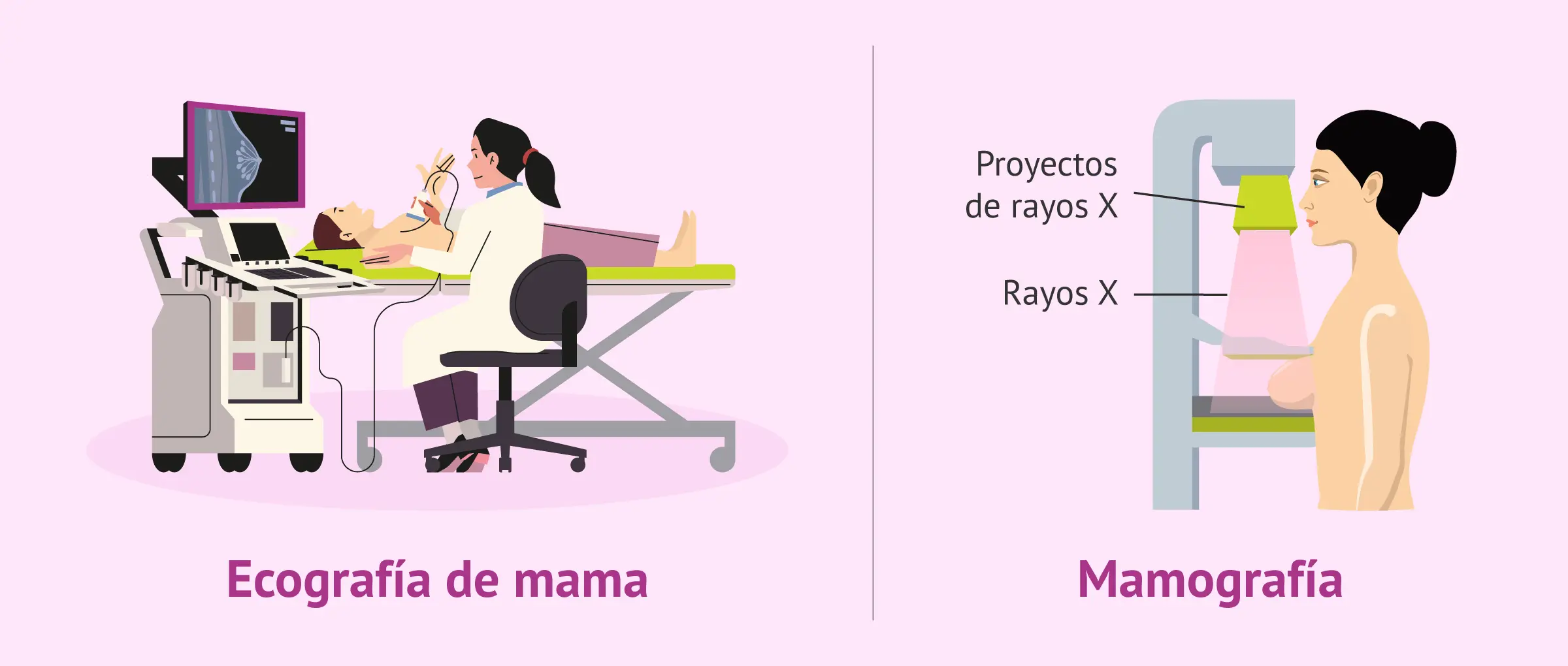 Mamografía y ecografía mamaria: una guía completa para la salud de tus senos - Qué se hace primero, la mamografía o la ecografía mamografia y ecografia - Qué se hace primero, la mamografía o la ecografía