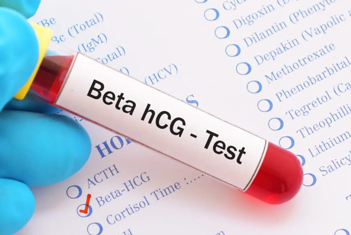 Examen de Sangre para Embarazo: Todo lo que Necesitas Saber - Qué se necesita para una prueba de embarazo de sangre examen de sangre embarazo - Qué se necesita para una prueba de embarazo de sangre
