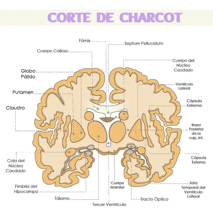 Corte de Charcot: Síntomas, Causas y Tratamiento - Qué se observa en un corte fleshing del cerebro corte de charcot - Qué se observa en un corte fleshing del cerebro