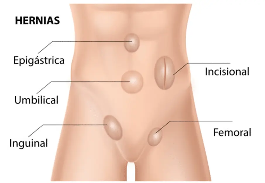 Ecografía de Partes Blandas del Abdomen: Qué es, Para Qué Sirve y Cómo se Realiza - Qué se puede ver en una ecografía de tejidos blandos ecografia partes blandas abdomen - Qué se puede ver en una ecografía de tejidos blandos