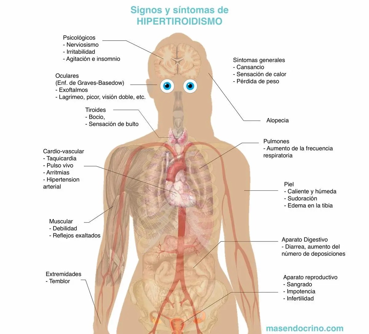 Dolor de Garganta y Tiroides: Síntomas y Causas - Qué se siente en la garganta si tienes tiroides tiroides: síntomas garganta - Qué se siente en la garganta si tienes tiroides