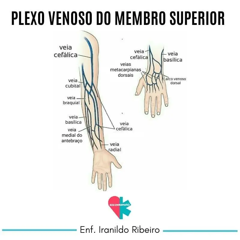 Ablación por Catéter de Venas Pulmonares (AVP): Un Procedimiento para la Fibrilación Auricular - Qué significa AVP en medicina avp medicina - Qué significa AVP en medicina