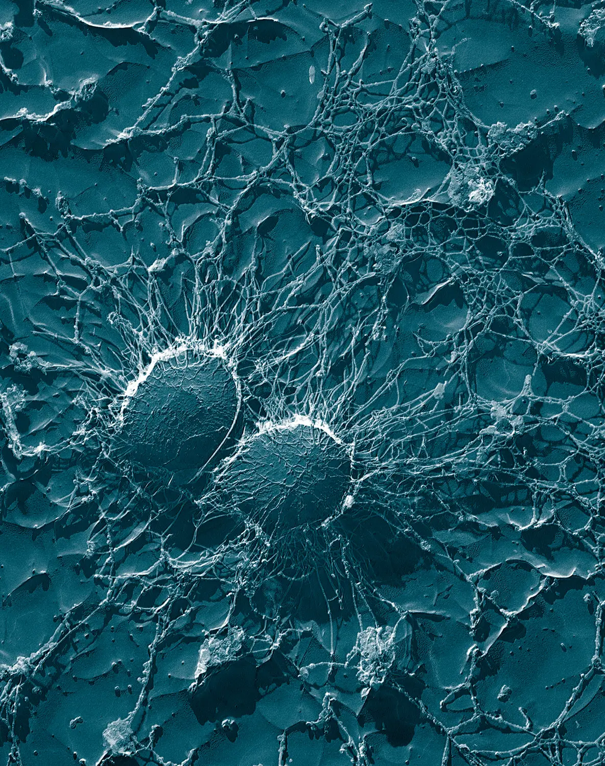 Staphylococcus Coagulasa Negativo: Un Reto Creciente en Infecciones Hospitalarias - Qué significa coagulasa positiva estafilo coagulasa negativo - Qué significa coagulasa positiva