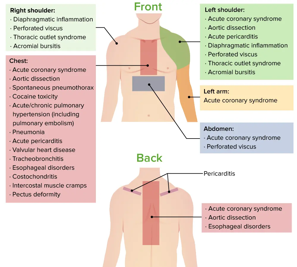 dolor retroesternal - Qué significa el dolor retroesternal