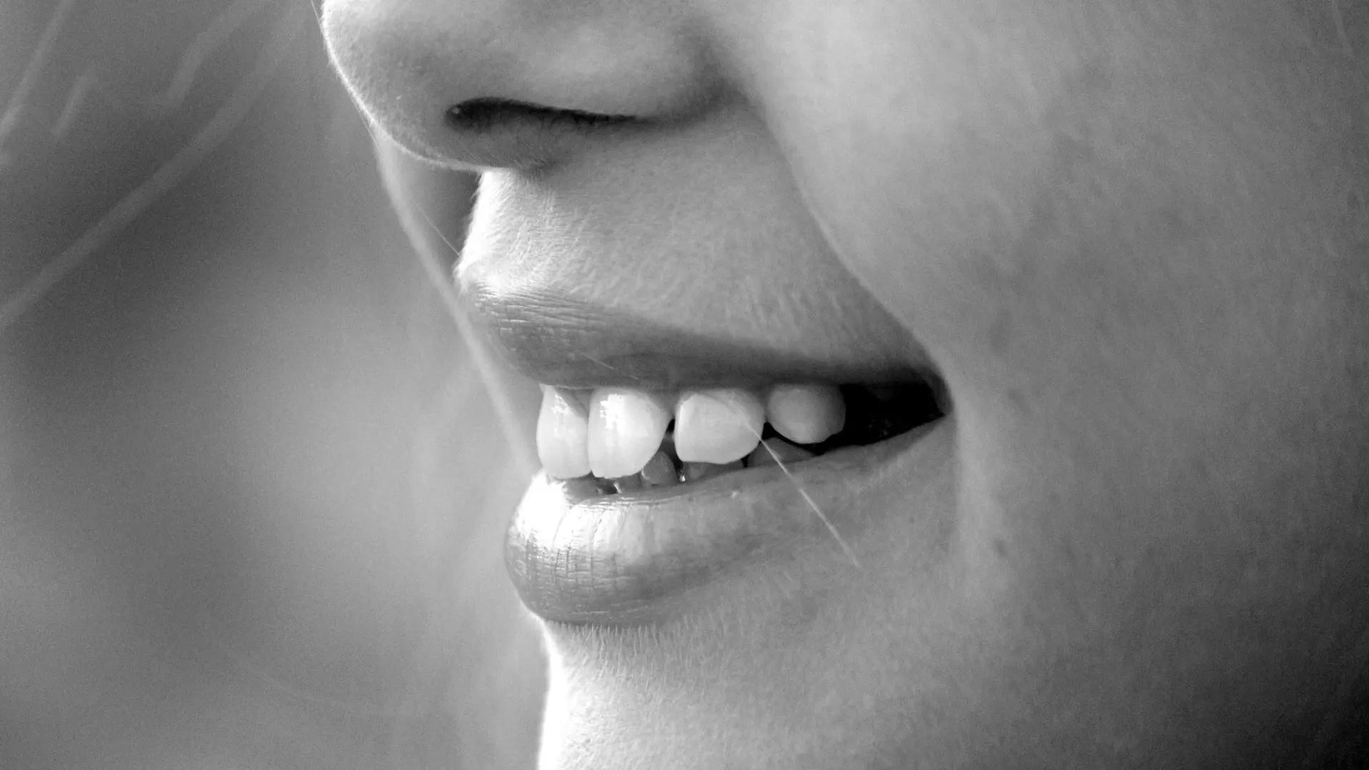 Cómo Eliminar los Surcos Nasolabiales: Guía Completa para un Rostro Joven - Qué significa el huequito entre los labios y la nariz surco nasolabial - Qué significa el huequito entre los labios y la nariz