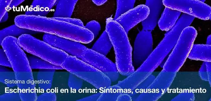Escherichia Coli en la orina: causas, síntomas y tratamiento - Qué significa encontrar Escherichia coli en un urocultivo escherichia coli en la orina - Qué significa encontrar Escherichia coli en un urocultivo