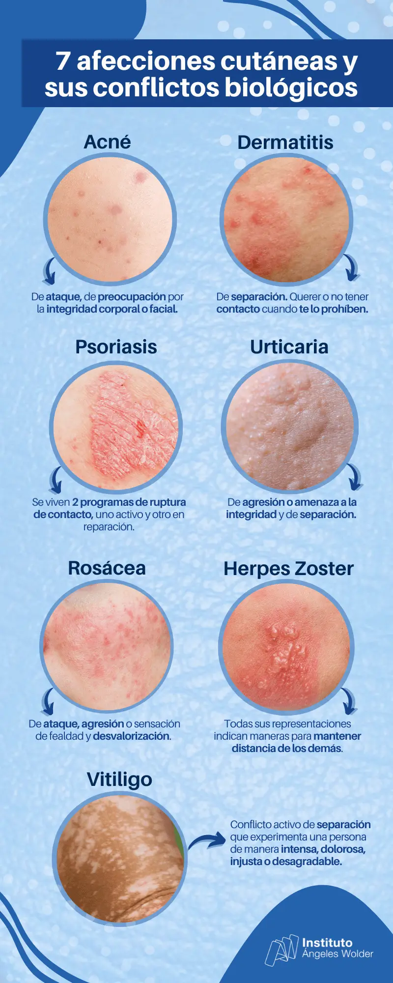 psoriasis biodescodificacion - Qué significa la piel en biodescodificación