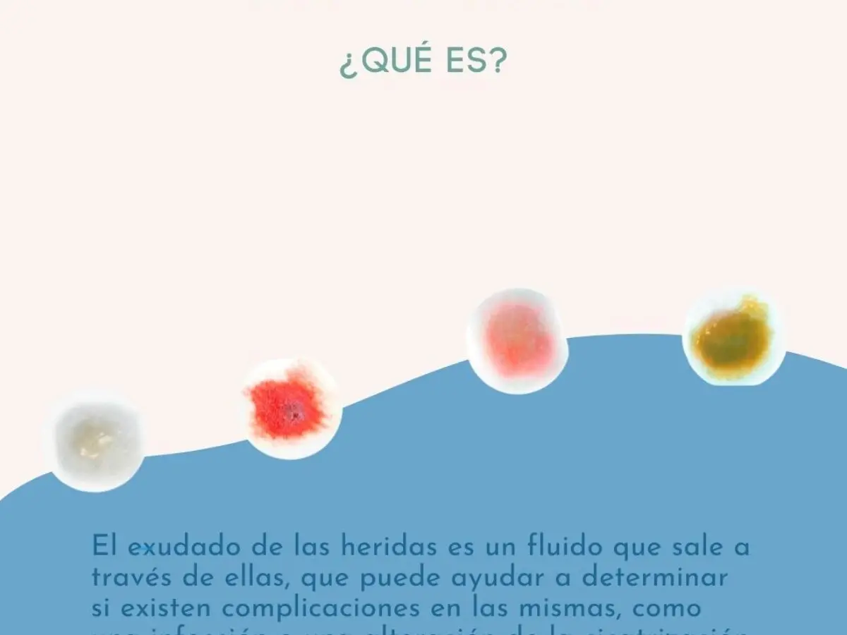 liquido seroso - Qué significa líquido seroso