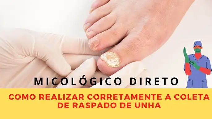 Micología: Explorando el fascinante mundo de los hongos - Qué significa micológico micologico - Qué significa micológico