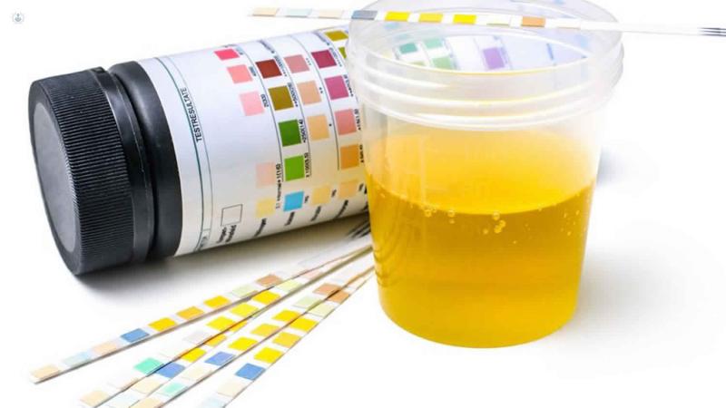 Proteína en la orina: Causas, síntomas y diagnóstico - Qué significa positivo en proteína proteina en la orina causas - Qué significa positivo en proteína