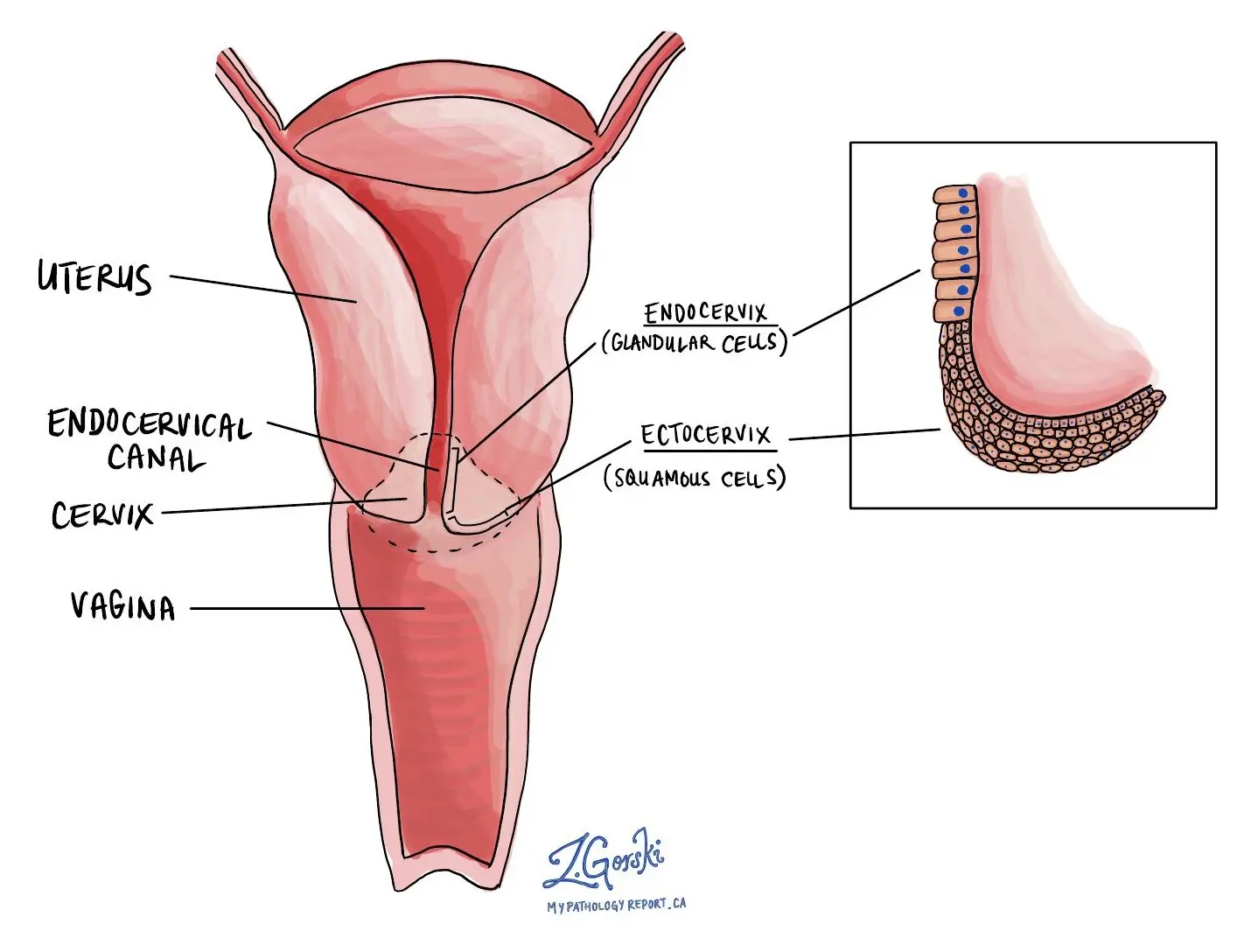 Endocérvix: Importancia en la Citología Cervical - Qué significa presencia de endocervicales endocervix - Qué significa presencia de endocervicales