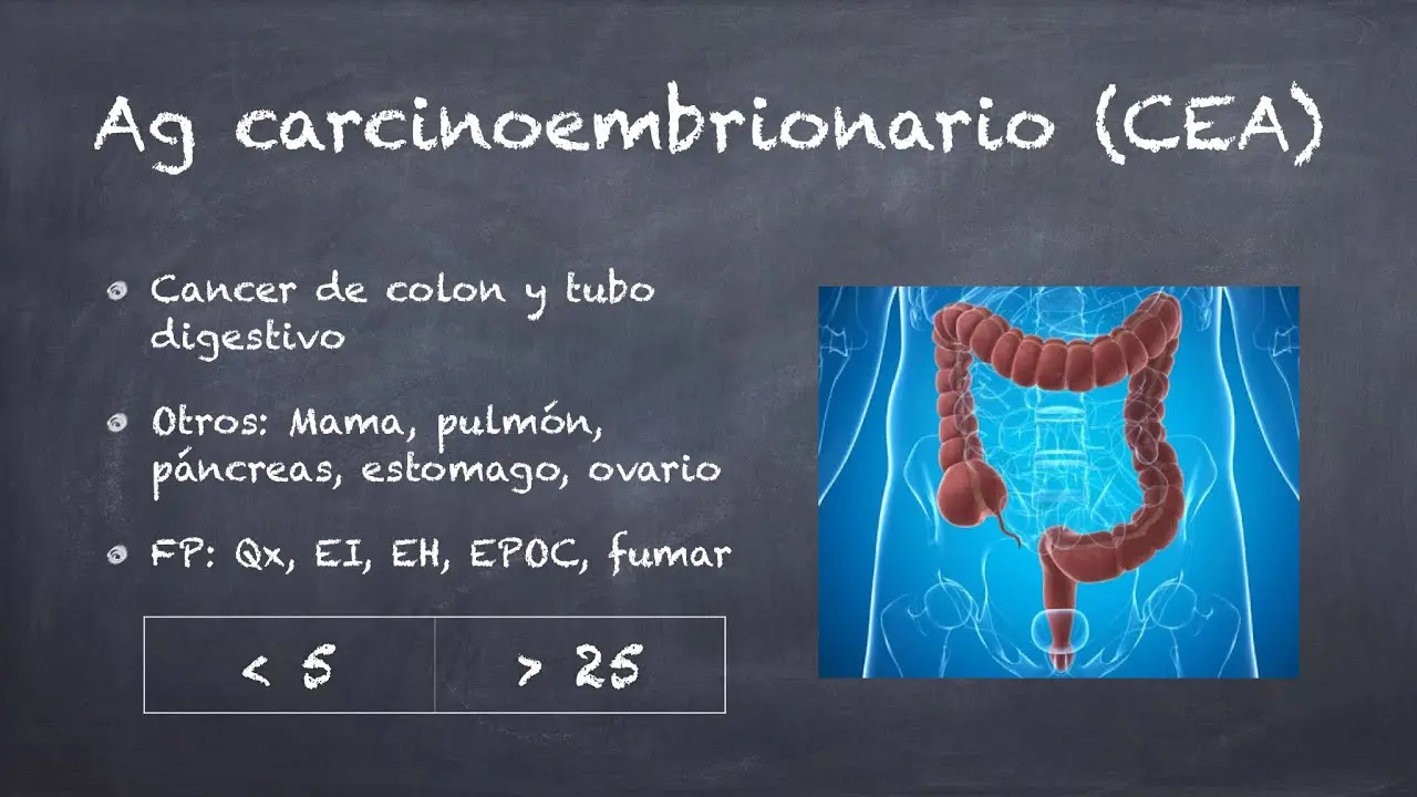 Antígeno Carcinoembrionario (CEA): Qué es, qué detecta y cuándo es elevado - Qué significa tener el CEA alto antigeno carcinoembrionario cea - Qué significa tener el CEA alto