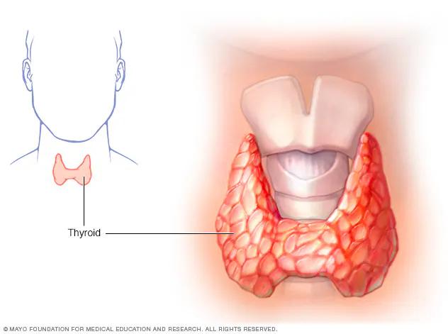 Tiroidectomía: Qué es, tipos, riesgos y recuperación - Qué significa tiroidectomía tiroidectomia - Qué significa tiroidectomía