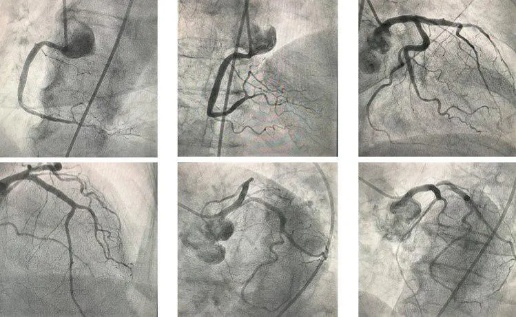 CCG en Cardiología: Una Guía Completa - Qué significan las siglas CCG ccg cardiologia - Qué significan las siglas CCG