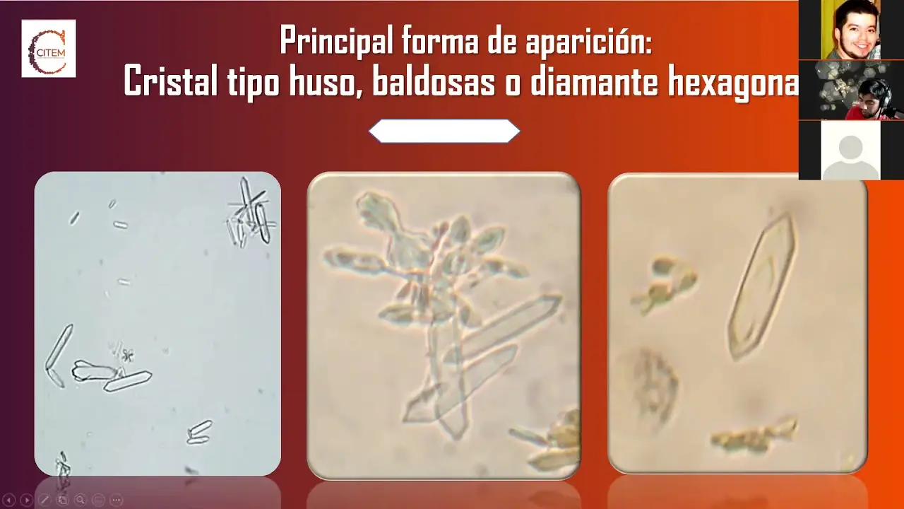 cristales en orina acida - Qué significan los cristales de ácido úrico