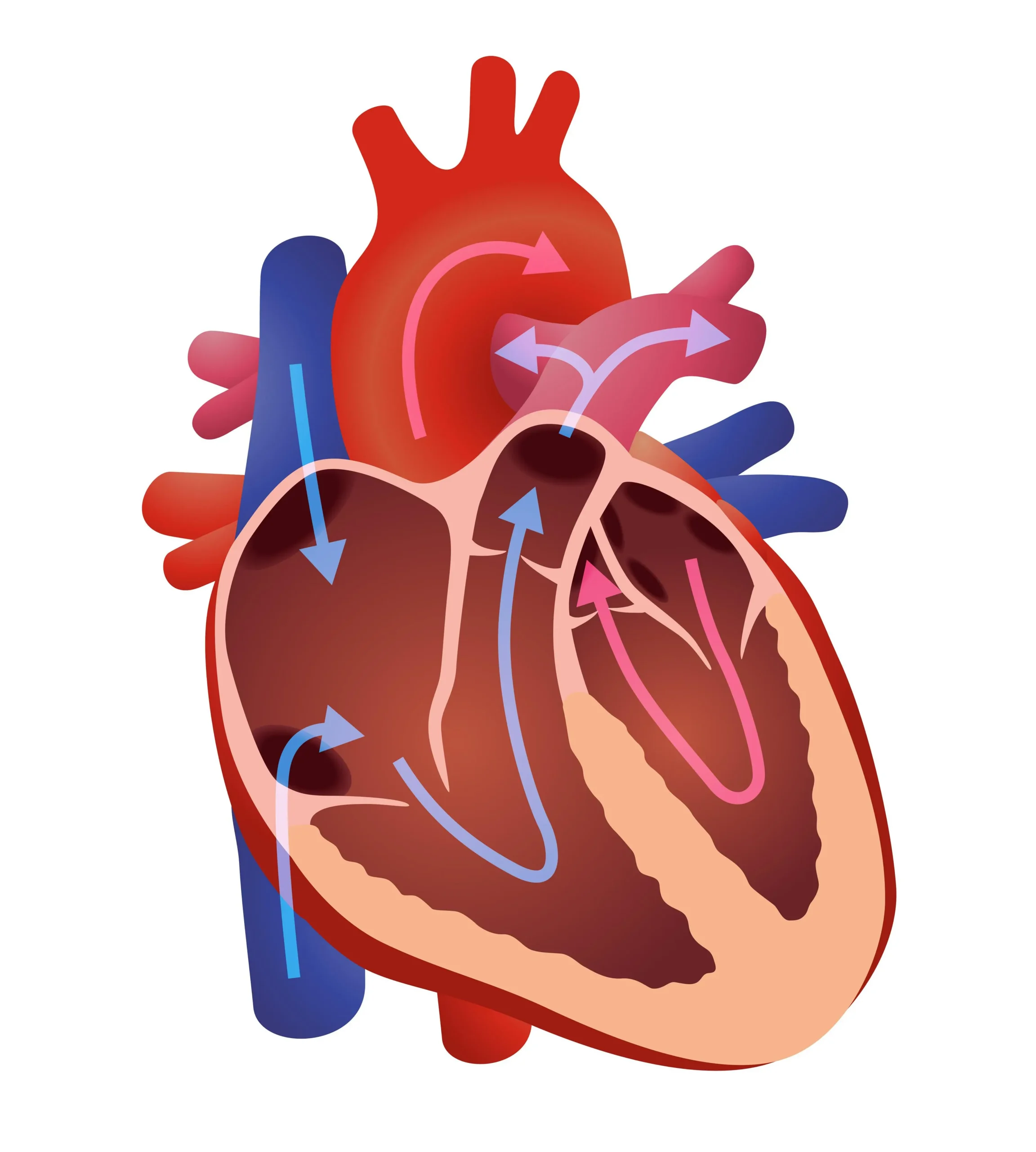 Insuficiencia Mitral Leve: ¿Qué es, Síntomas, Causas y Tratamiento? - Qué síntomas da la válvula mitral insuficiencia mitral leve - Qué síntomas da la válvula mitral