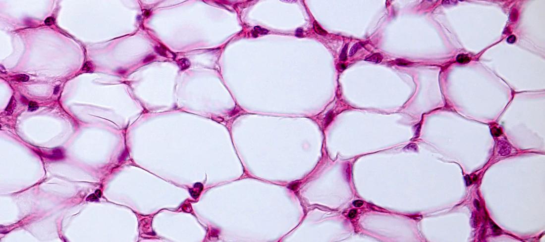 Adipocitos: Las células grasas y su importancia en el metabolismo - Qué son los adipocitos y cuál es su función adipocitos - Qué son los adipocitos y cuál es su función