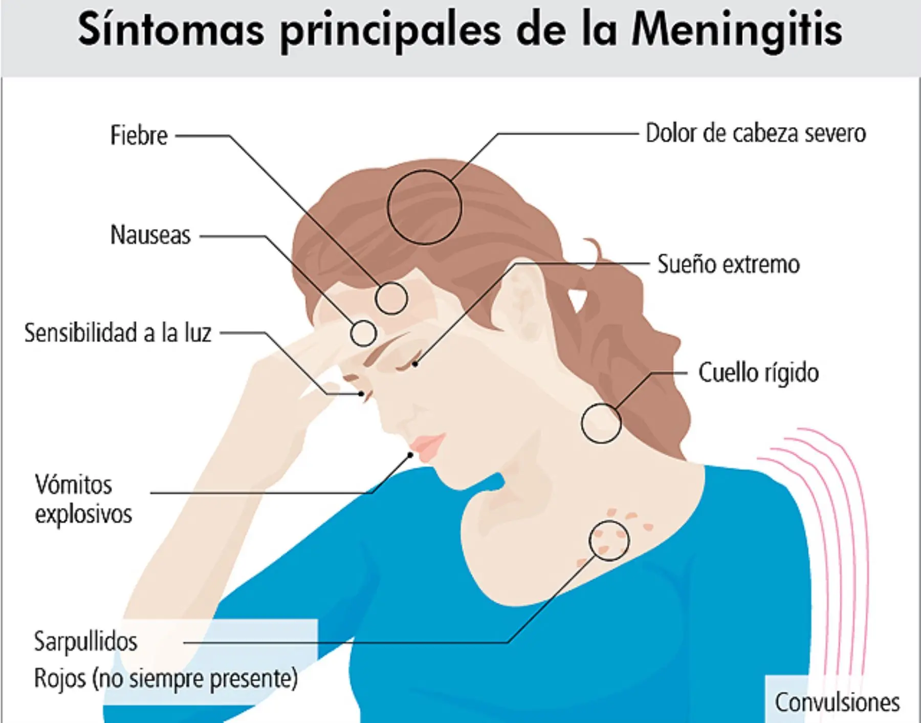 Temblores en la cabeza: Causas, tipos y tratamiento - Qué son los temblores en la cabeza escalofrios en la cabeza - Qué son los temblores en la cabeza