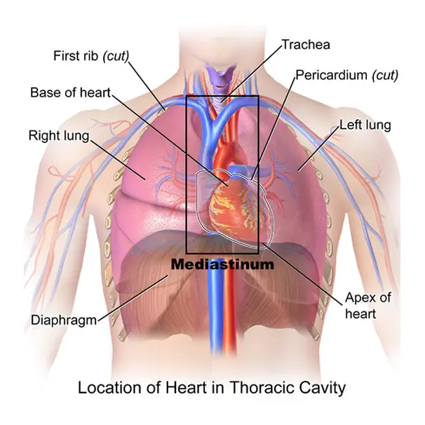 Cáncer de mediastino: síntomas, causas, tratamiento y prevención - Qué tan agresivo es el cáncer de mediastino cancer de mediastino - Qué tan agresivo es el cáncer de mediastino