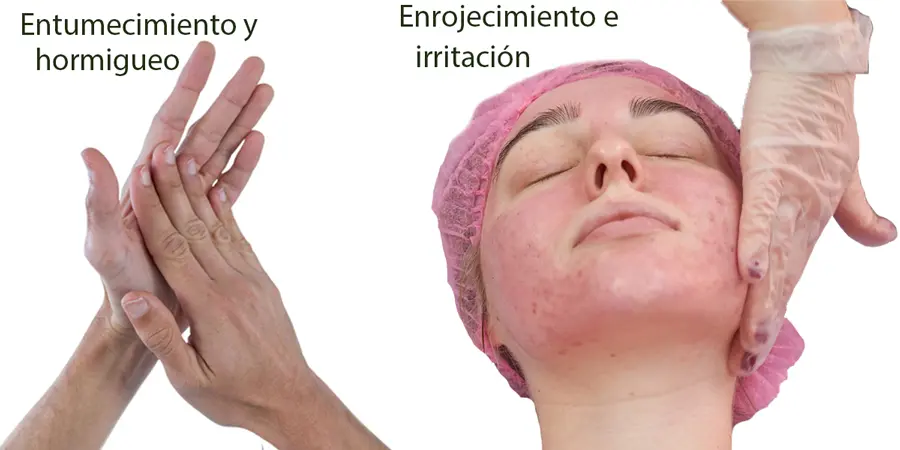 crioterapia que es - Qué tan buena es la crioterapia