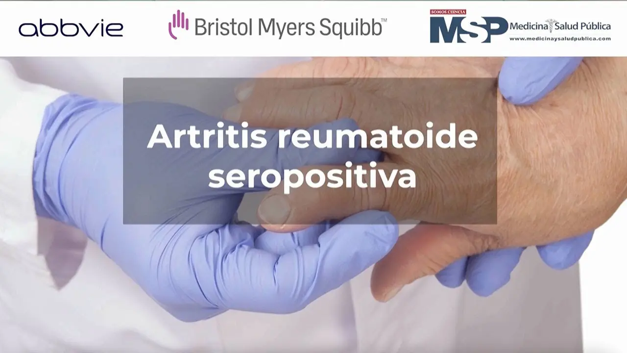 Artritis Reumatoide Seropositiva: Una Mirada Profunda a la Enfermedad en Adultos Mayores - Qué tan grave es la artritis reumatoide seropositiva artritis reumatoide seropositiva - Qué tan grave es la artritis reumatoide seropositiva