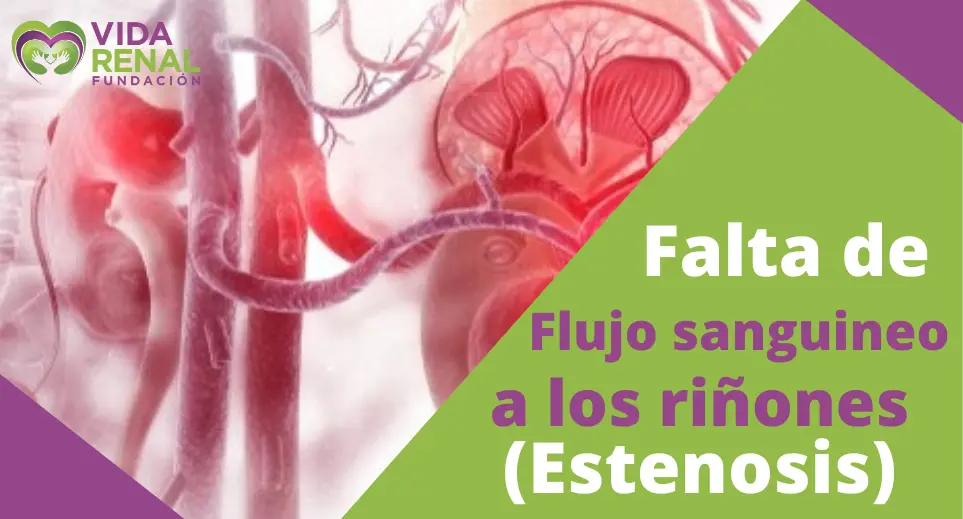 Estenosis de la Arteria Renal: Causas, Síntomas, Diagnóstico y Tratamiento - Qué tan grave es la estenosis de la arteria renal estenosis renal - Qué tan grave es la estenosis de la arteria renal