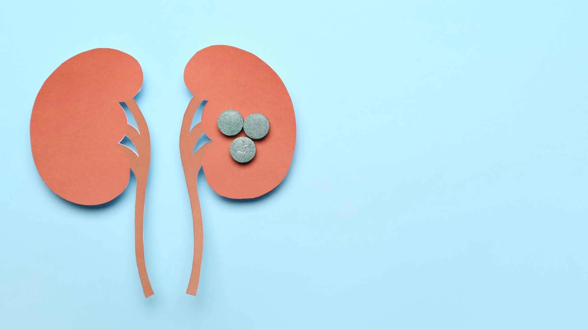 Microlitiasis Testicular: Qué es, Causas, Síntomas y Diagnóstico - Qué tan peligrosa es la microlitiasis testicular que es microlitiasis - Qué tan peligrosa es la microlitiasis testicular