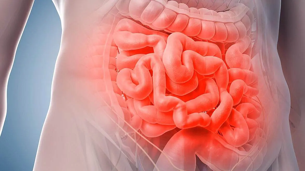 Tumor en el Intestino: Diagnóstico, Tratamiento y Todo lo que Necesitas Saber - Qué tan peligroso es tener un tumor en el intestino tumor en el intestino - Qué tan peligroso es tener un tumor en el intestino