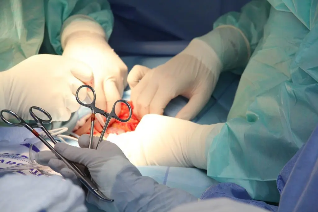 Cirugía de Cáncer de Mama: Riesgos, Tipos y Recuperación - Qué tan riesgosa es una cirugía de cáncer de mama operacion de cancer de mama - Qué tan riesgosa es una cirugía de cáncer de mama