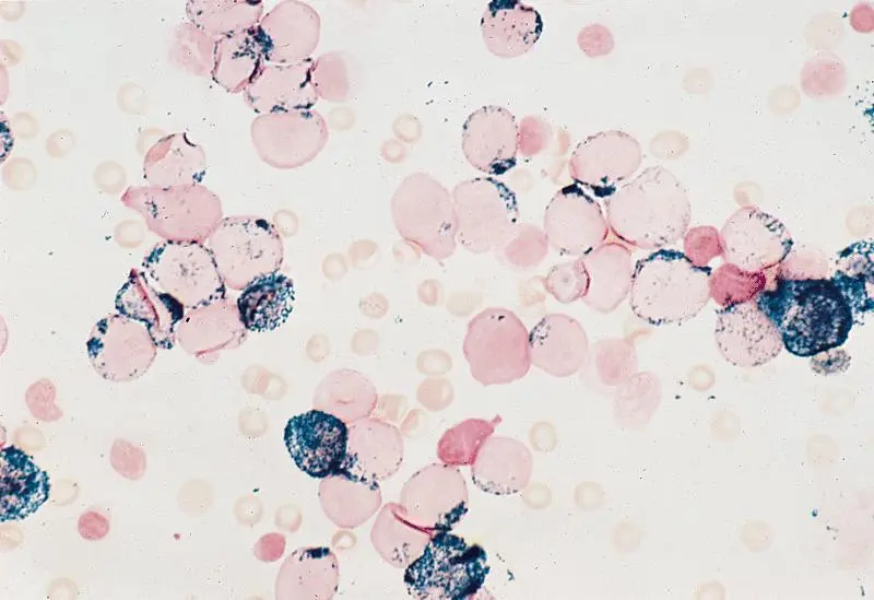 Mieloperoxidasa: Un Marcador Clave en la Detección de Enfermedades - Qué tiñe la mieloperoxidasa mieloperoxidasa - Qué tiñe la mieloperoxidasa