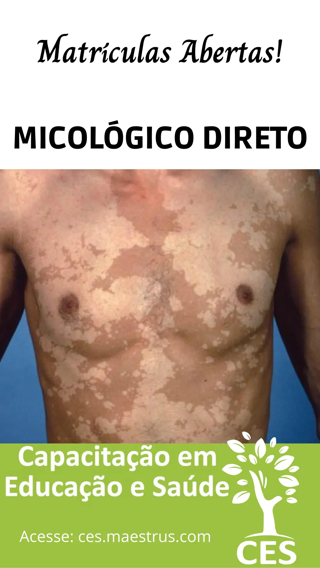 Micología: Explorando el fascinante mundo de los hongos - Qué tipo de hongos estudia la micología micologico - Qué tipo de hongos estudia la micología