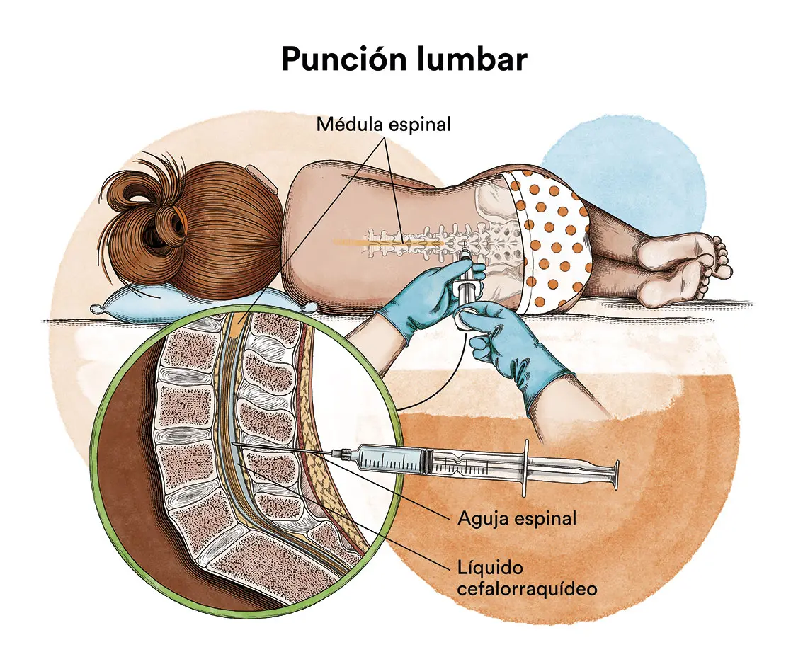 Leucemia: ¿Es contagiosa? Todo lo que necesitas saber - Qué tipo de leucemia no es contagiosa la leucemia es contagiosa - Qué tipo de leucemia no es contagiosa