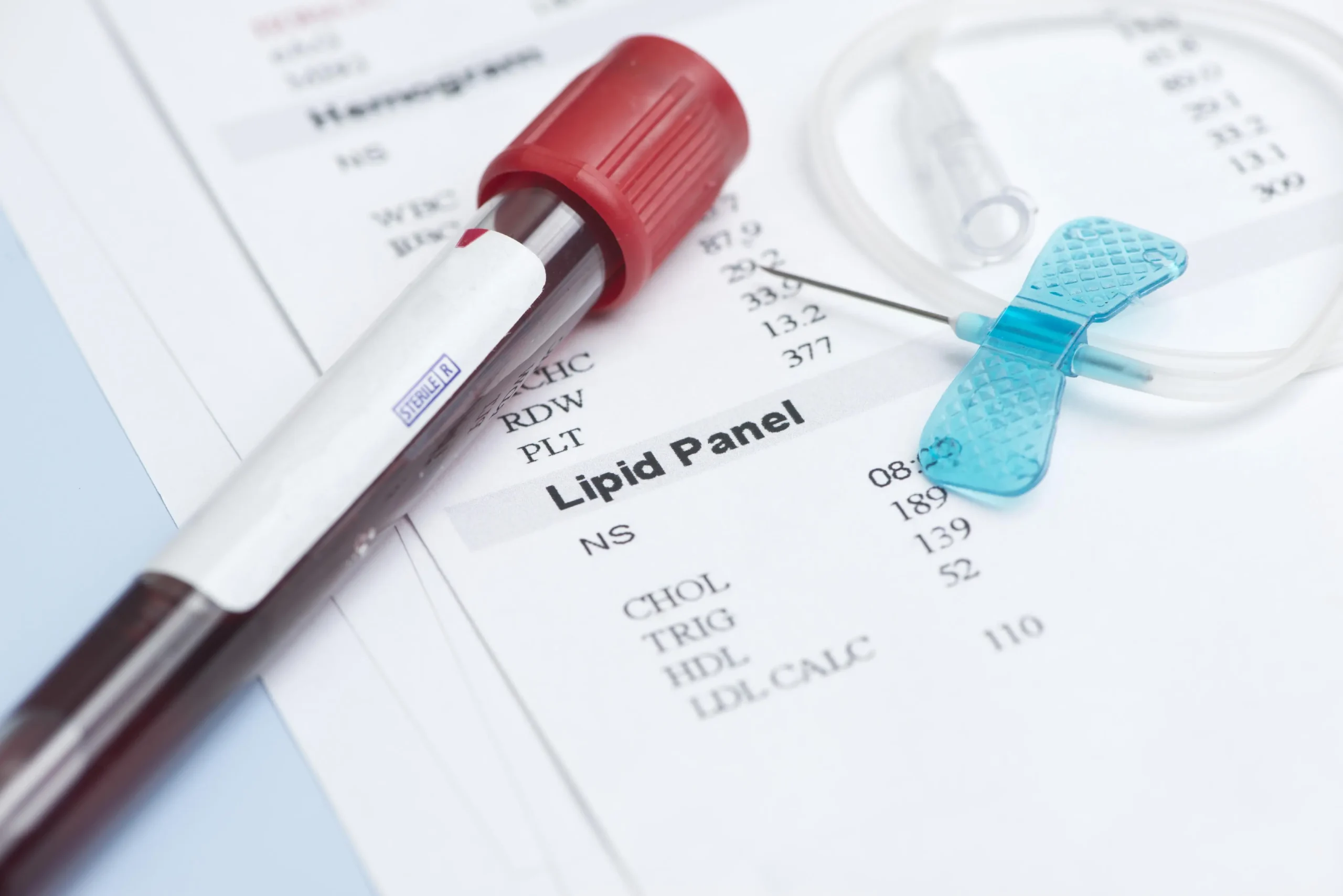 Triacilgliceroles: Función, niveles y salud cardiovascular - Qué tipo de lípidos son los triacilglicéridos triacilglicerol - Qué tipo de lípidos son los triacilglicéridos