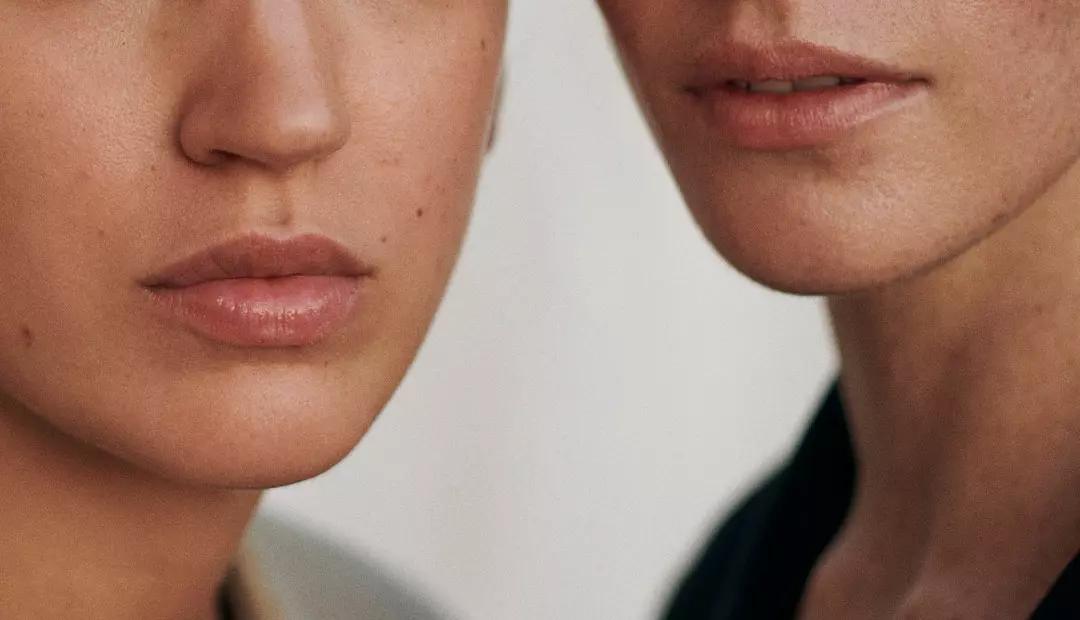 Labios Paspados: Causas, Remedios y Consejos para Labios Sanos - Qué vitamina falta si se resecan los labios labios paspados - Qué vitamina falta si se resecan los labios