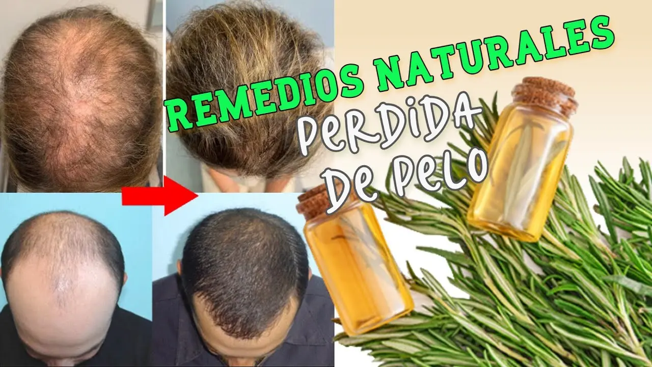 Qué vitamina me falta si se me cae el cabello: Guía completa para combatir la caída capilar - Qué vitamina me falta si se me cae el cabello para la caida del cabello - Qué vitamina me falta si se me cae el cabello