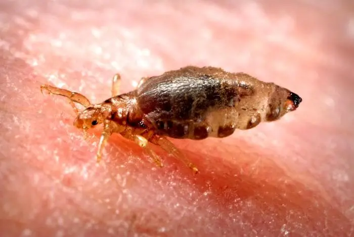 Vacuna contra la Fiebre Tifoidea: Todo lo que necesitas saber - Tenemos una vacuna contra el tifus vacuna tifus - Tenemos una vacuna contra el tifus